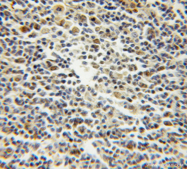 TCOF1 Antibody in Immunohistochemistry (Paraffin) (IHC (P))