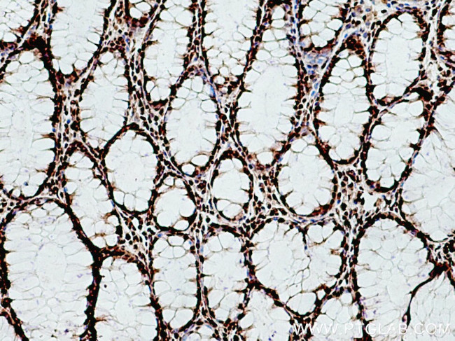 TCOF1 Antibody in Immunohistochemistry (Paraffin) (IHC (P))