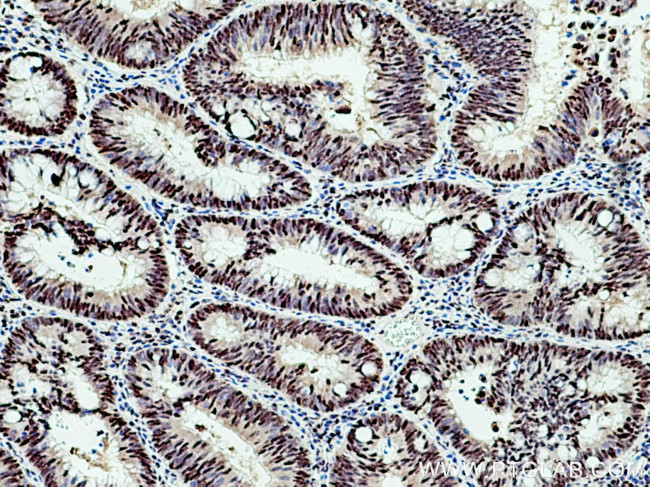 TCOF1 Antibody in Immunohistochemistry (Paraffin) (IHC (P))