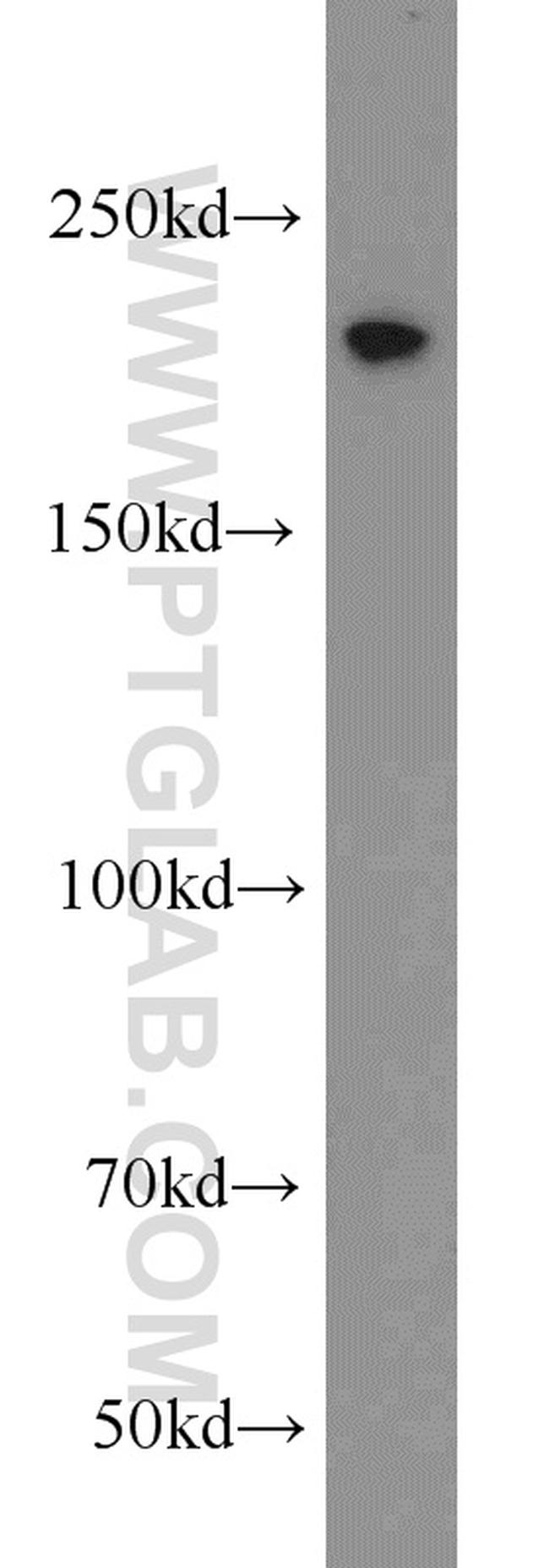 TCOF1 Antibody in Western Blot (WB)