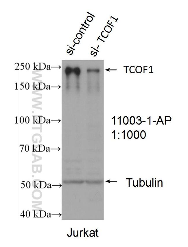 TCOF1 Antibody in Western Blot (WB)