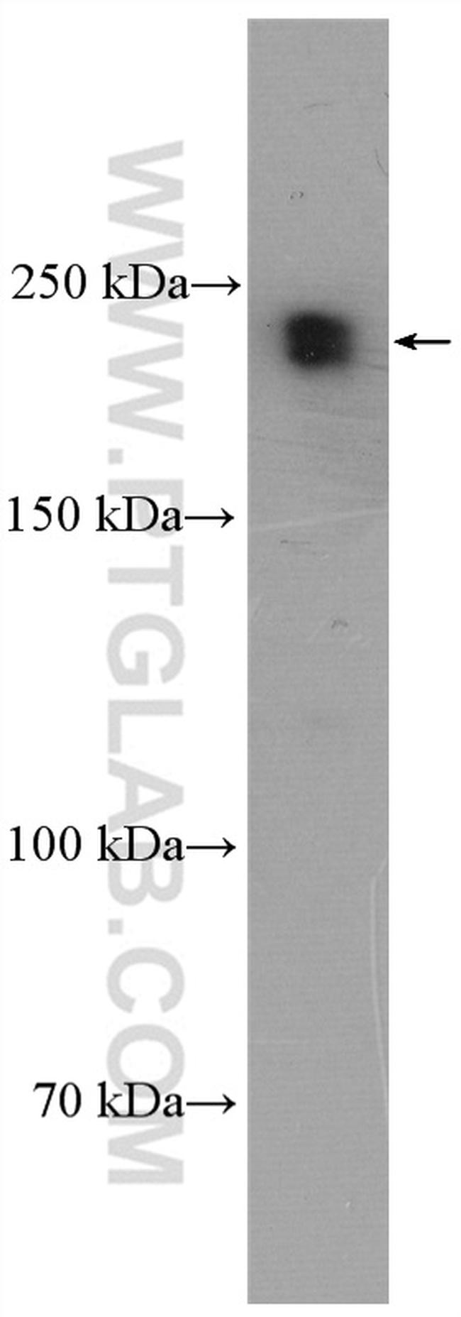 TCOF1 Antibody in Western Blot (WB)