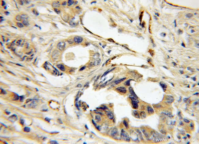 LDB3 Antibody in Immunohistochemistry (Paraffin) (IHC (P))