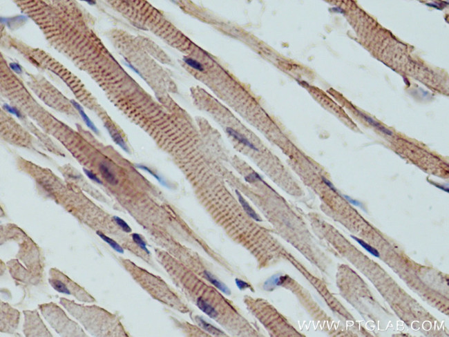 LDB3 Antibody in Immunohistochemistry (Paraffin) (IHC (P))