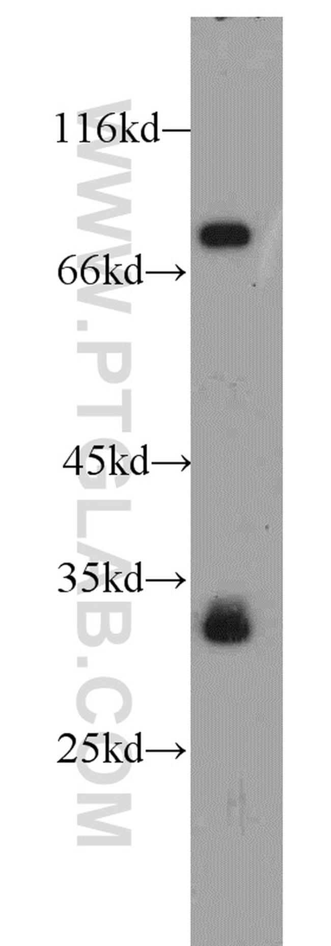 LDB3 Antibody in Western Blot (WB)