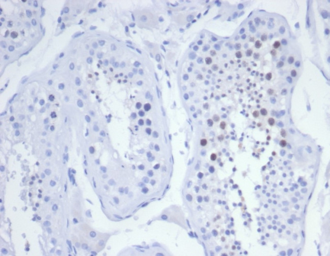 KIF2C (Kinesin Family Member 2C)/MCAK Antibody in Immunohistochemistry (Paraffin) (IHC (P))