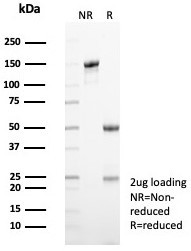 KIF2C (Kinesin Family Member 2C)/MCAK Antibody in SDS-PAGE (SDS-PAGE)