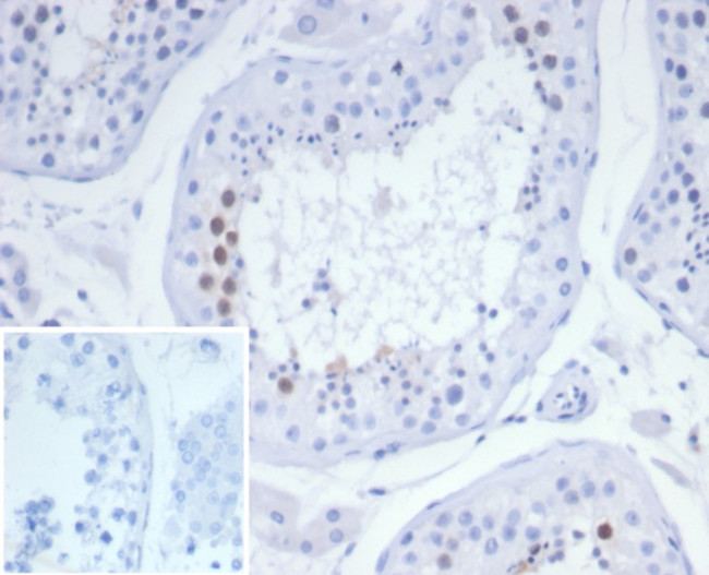 KIF2C (Kinesin Family Member 2C)/MCAK Antibody in Immunohistochemistry (Paraffin) (IHC (P))