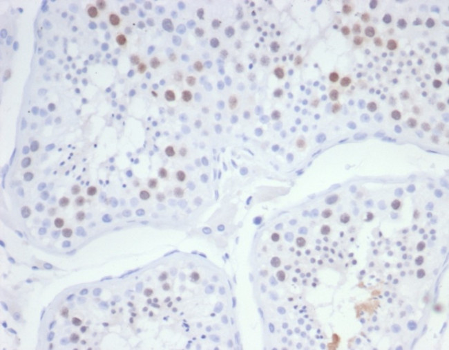 KIF2C (Kinesin Family Member 2C)/MCAK Antibody in Immunohistochemistry (Paraffin) (IHC (P))