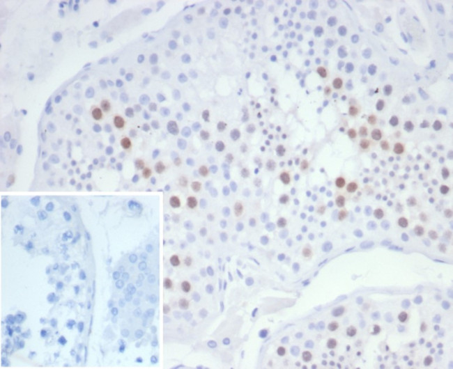 KIF2C (Kinesin Family Member 2C)/MCAK Antibody in Immunohistochemistry (Paraffin) (IHC (P))