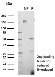 KIF2C (Kinesin Family Member 2C)/MCAK Antibody in SDS-PAGE (SDS-PAGE)