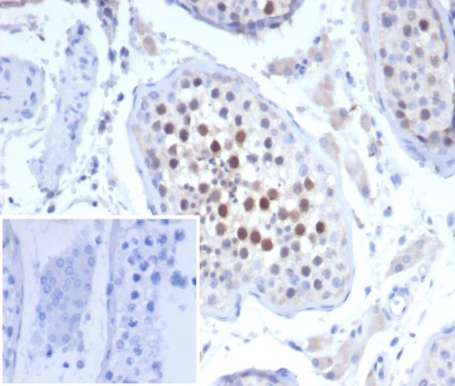 KIF2C (Kinesin Family Member 2C)/MCAK Antibody in Immunohistochemistry (Paraffin) (IHC (P))