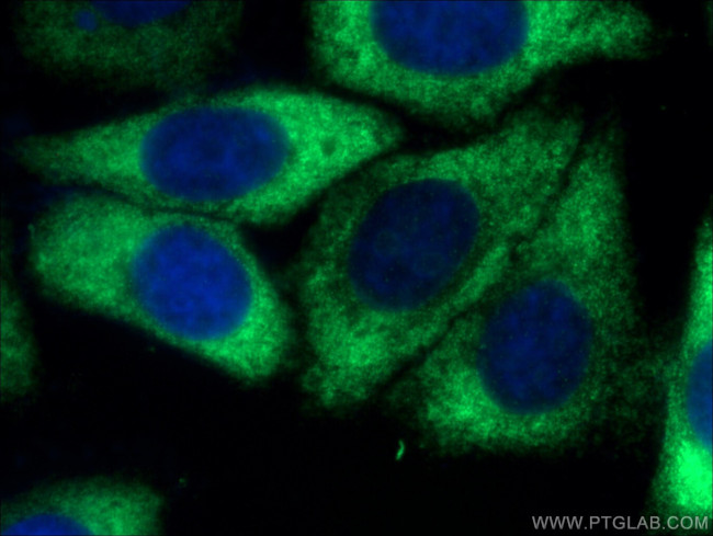 RPL3 Antibody in Immunocytochemistry (ICC/IF)