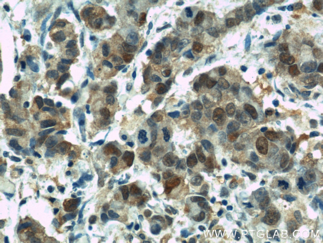 RPL3 Antibody in Immunohistochemistry (Paraffin) (IHC (P))