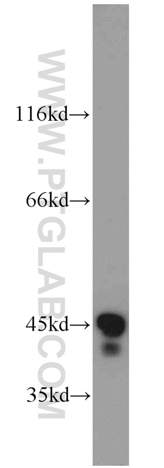 RPL3 Antibody in Western Blot (WB)