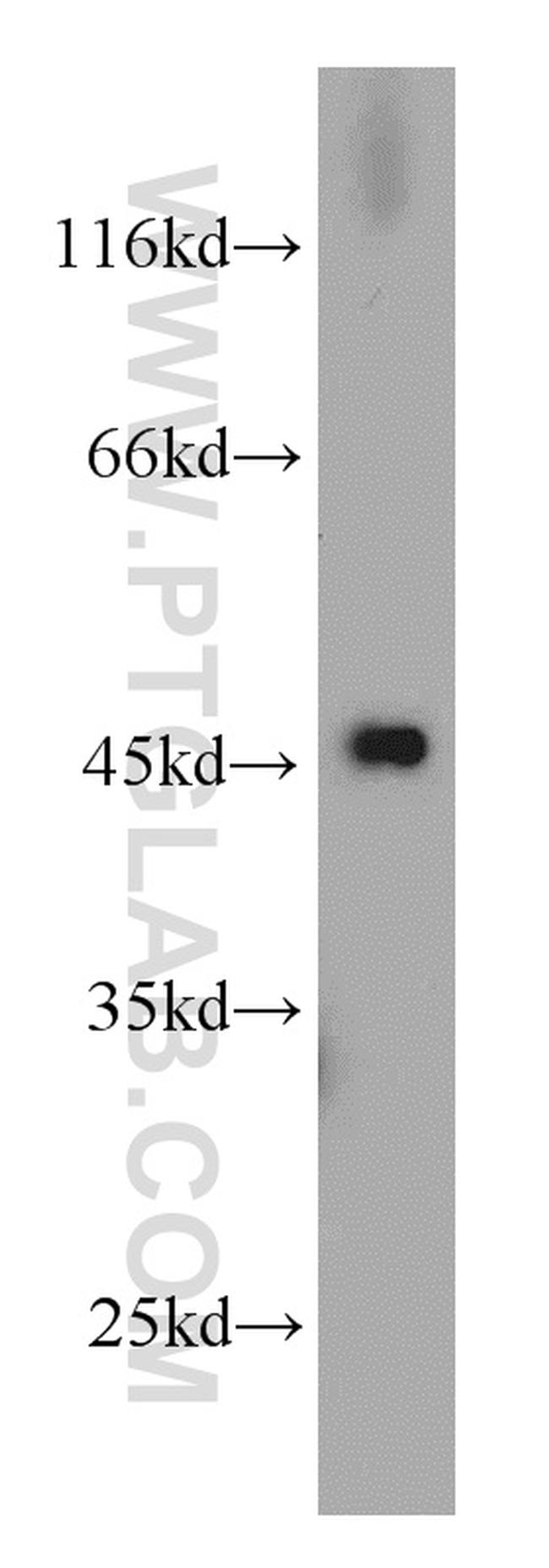 RPL3 Antibody in Western Blot (WB)