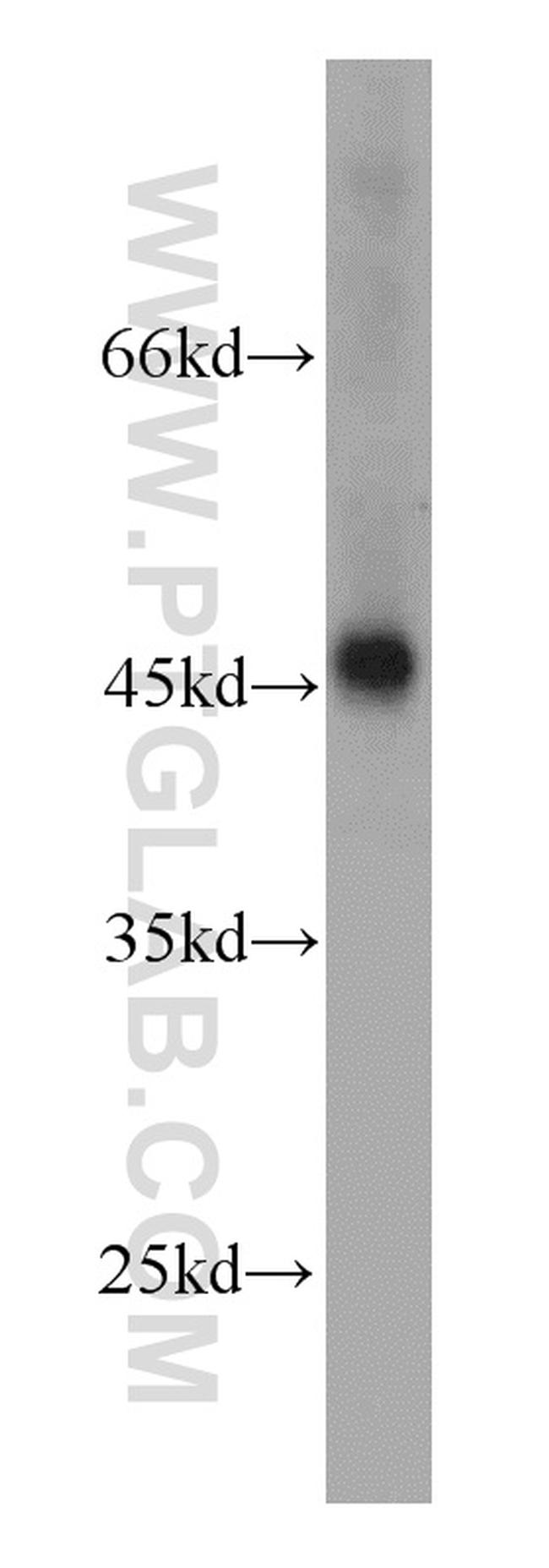 RPL3 Antibody in Western Blot (WB)