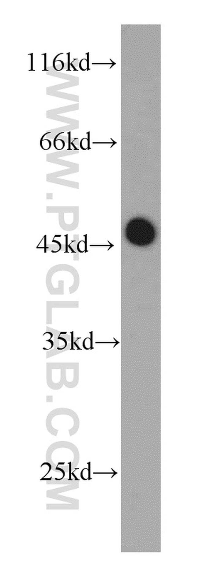 RPL3 Antibody in Western Blot (WB)