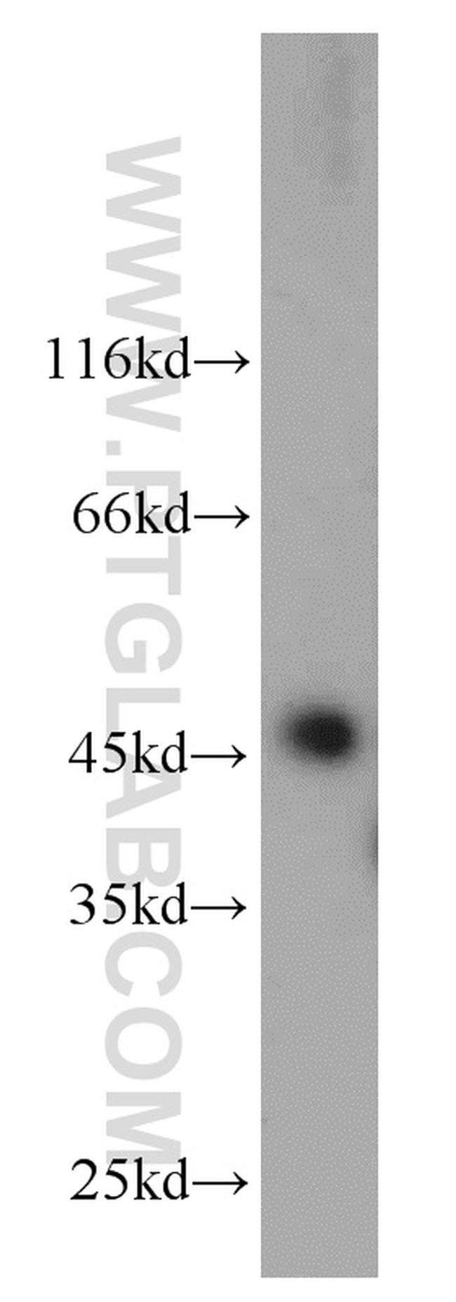 RPL3 Antibody in Western Blot (WB)