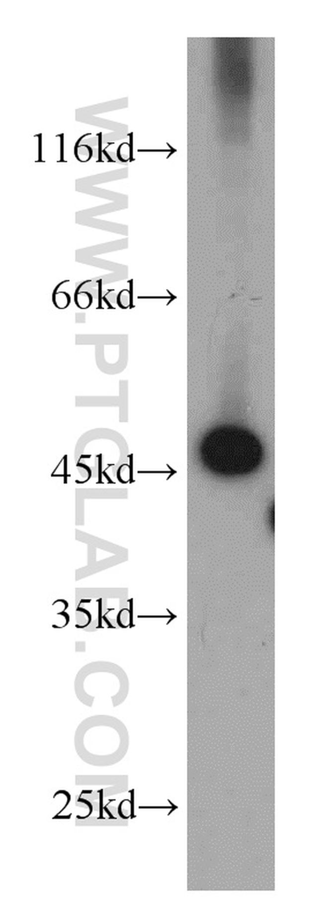 RPL3 Antibody in Western Blot (WB)