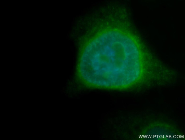 PPAN Antibody in Immunocytochemistry (ICC/IF)