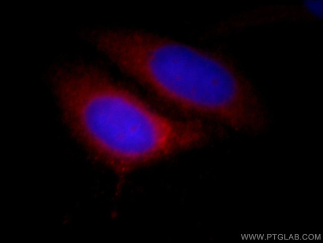 CDK5RAP3 Antibody in Immunocytochemistry (ICC/IF)