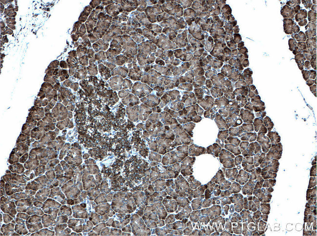 CDK5RAP3 Antibody in Immunohistochemistry (Paraffin) (IHC (P))