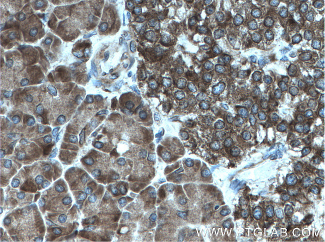 CDK5RAP3 Antibody in Immunohistochemistry (Paraffin) (IHC (P))