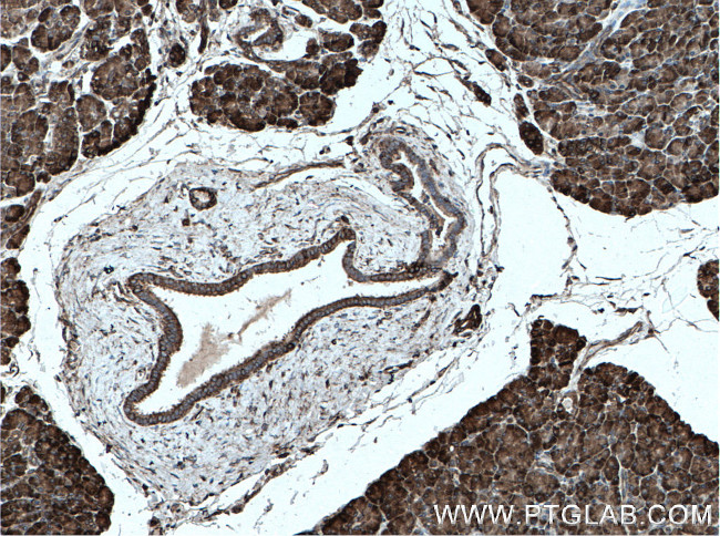 CDK5RAP3 Antibody in Immunohistochemistry (Paraffin) (IHC (P))