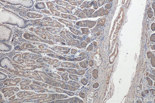 CDK5RAP3 Antibody in Immunohistochemistry (Paraffin) (IHC (P))