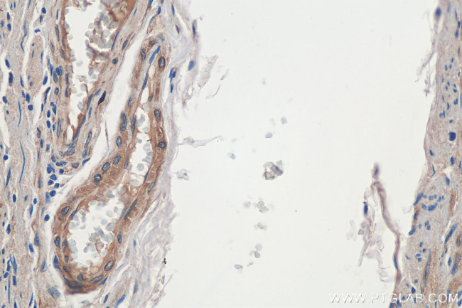 CDK5RAP3 Antibody in Immunohistochemistry (Paraffin) (IHC (P))