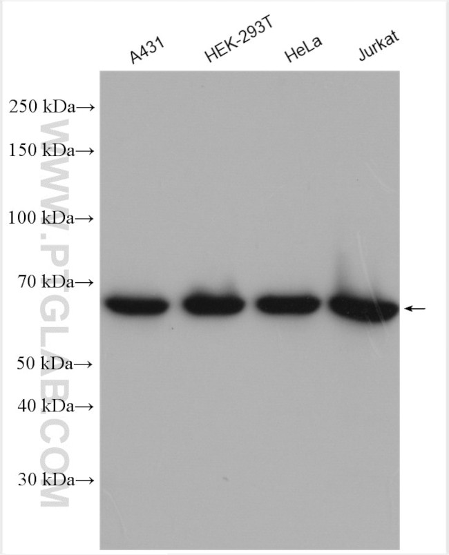 CDK5RAP3 Antibody in Western Blot (WB)