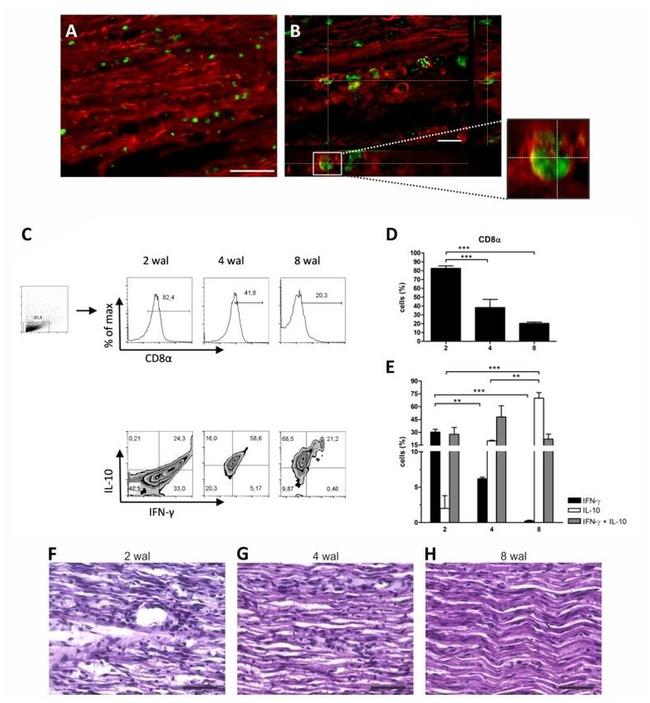 CD8a Antibody in Immunohistochemistry (IHC)