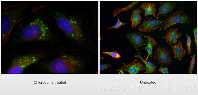 GABARAPL1 Antibody in Immunocytochemistry (ICC/IF)