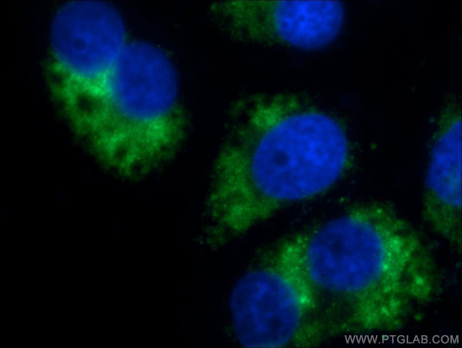 GABARAPL1 Antibody in Immunocytochemistry (ICC/IF)