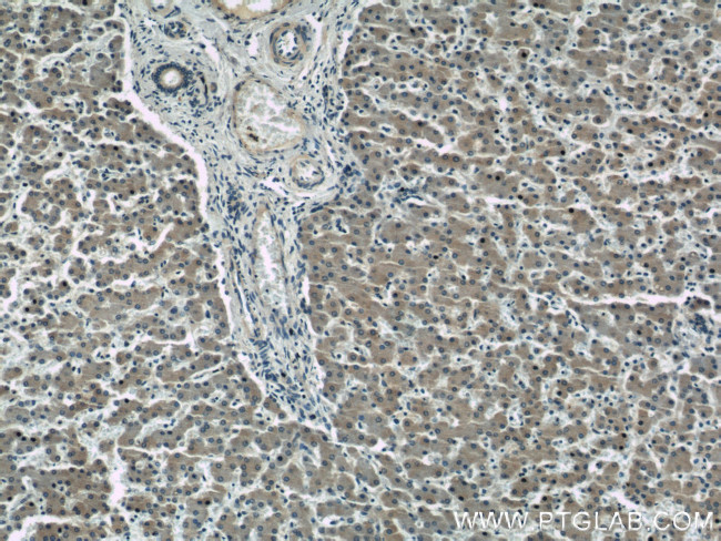 GABARAPL1 Antibody in Immunohistochemistry (Paraffin) (IHC (P))