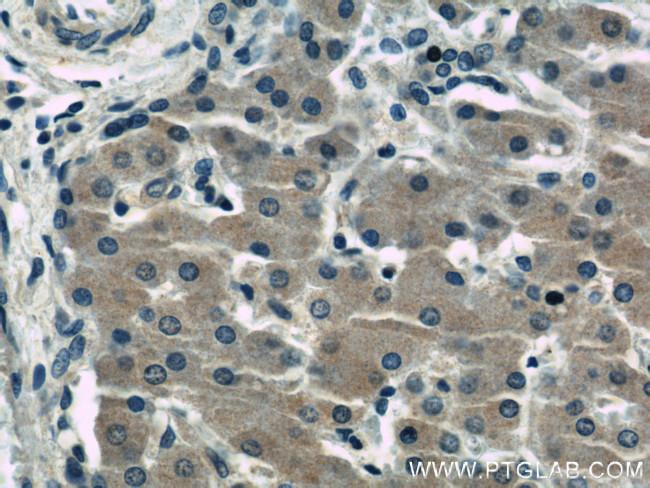 GABARAPL1 Antibody in Immunohistochemistry (Paraffin) (IHC (P))