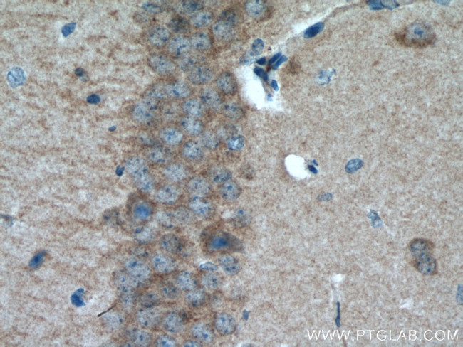 GABARAPL1 Antibody in Immunohistochemistry (Paraffin) (IHC (P))