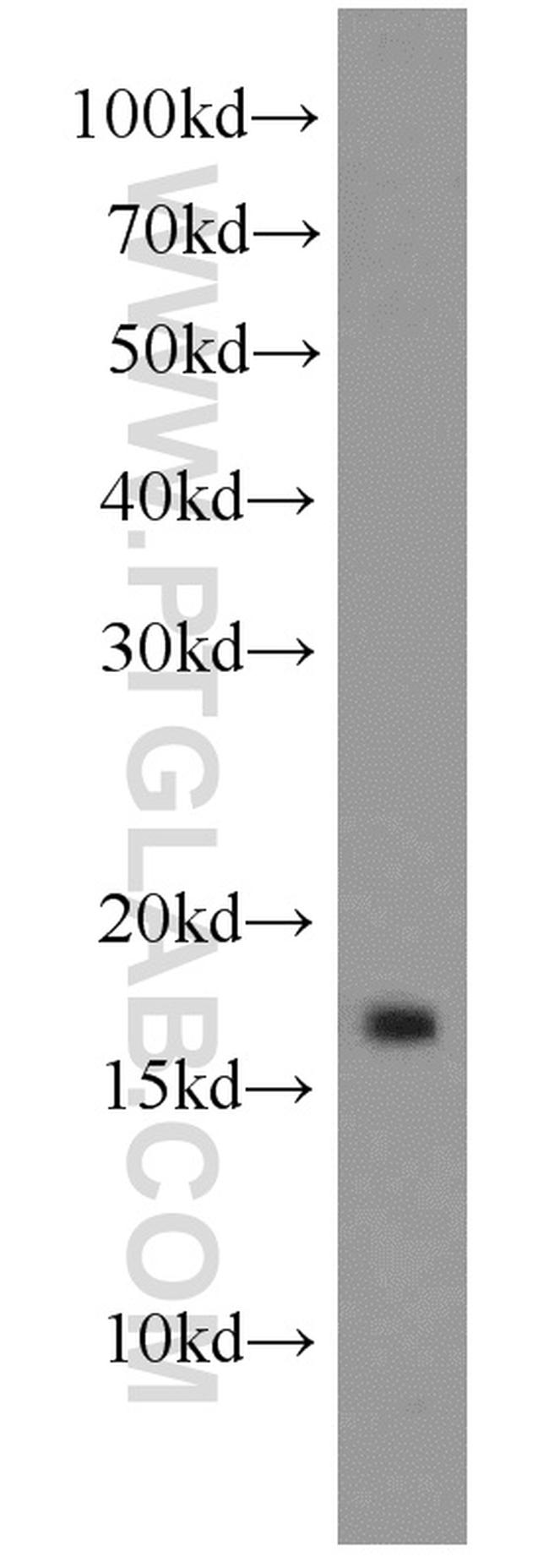 GABARAPL1 Antibody in Western Blot (WB)