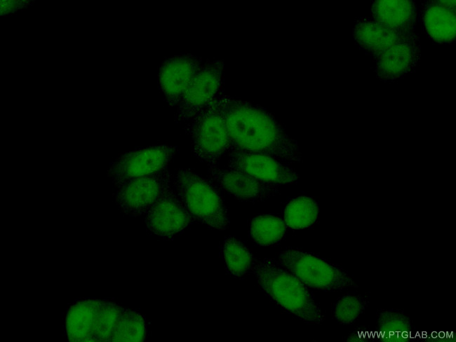 ASF1B Antibody in Immunocytochemistry (ICC/IF)