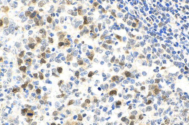 ASF1B Antibody in Immunohistochemistry (Paraffin) (IHC (P))