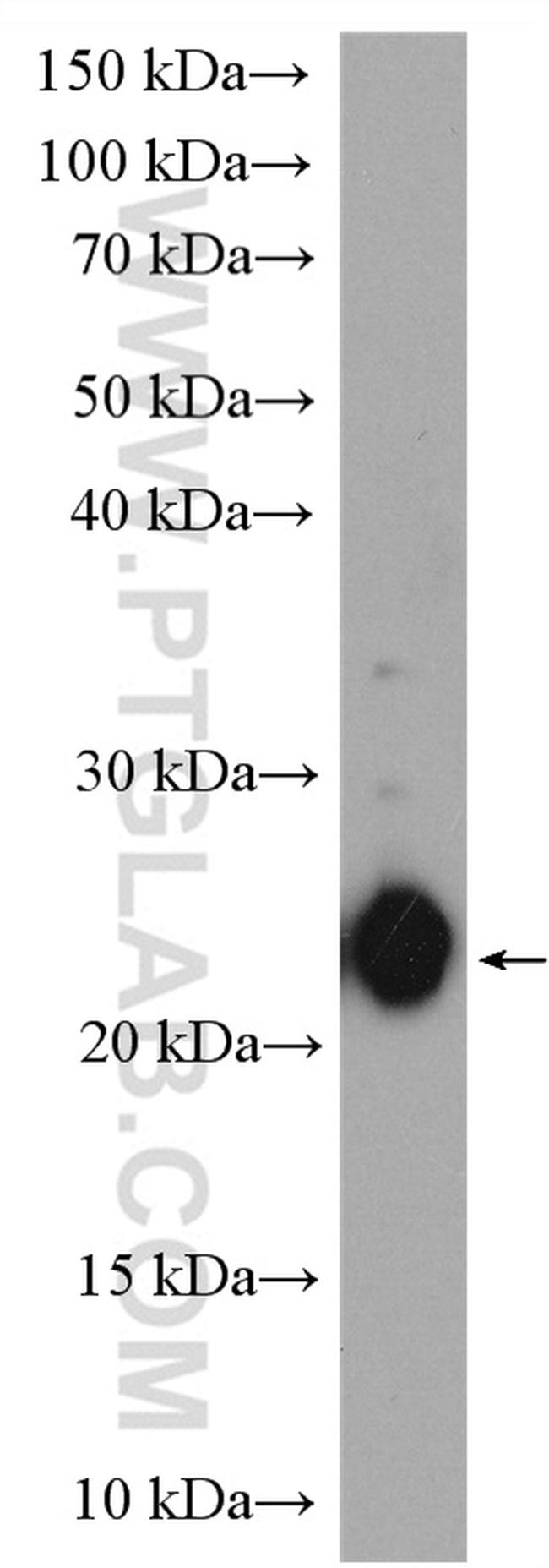 ASF1B Antibody in Western Blot (WB)