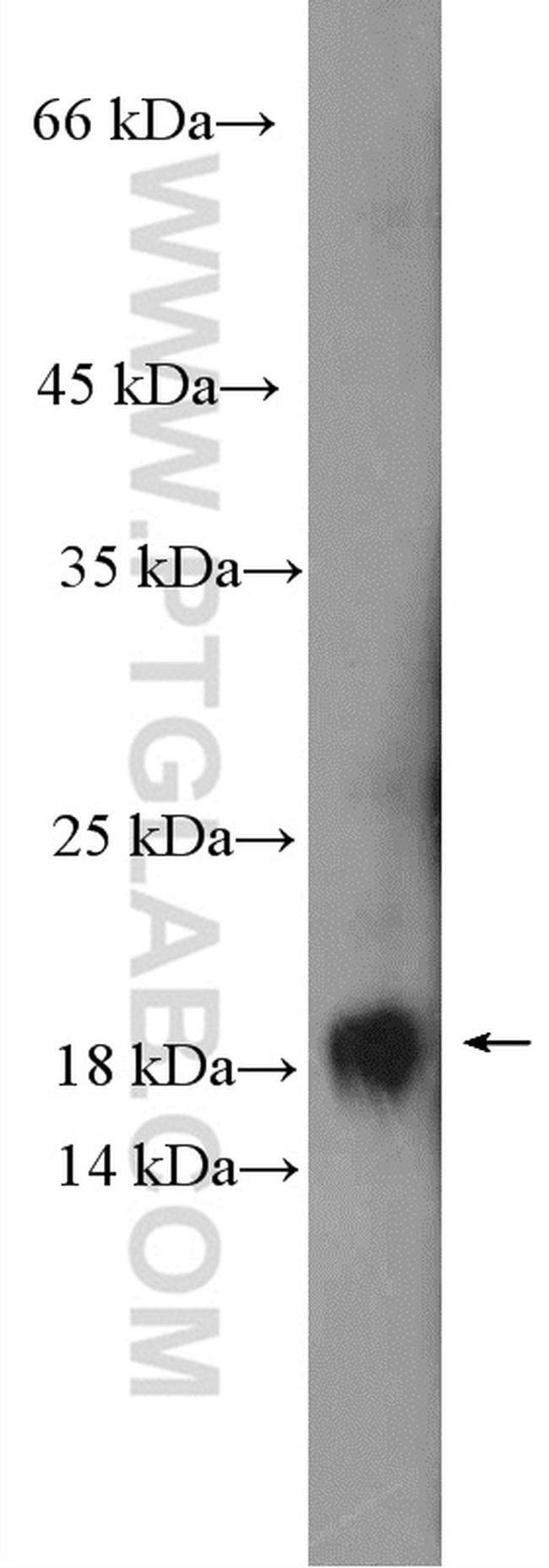 ASF1B Antibody in Western Blot (WB)