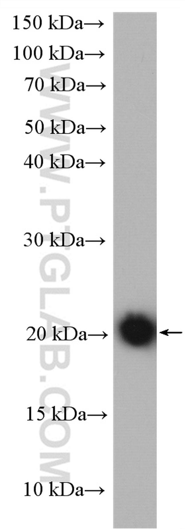 ASF1B Antibody in Western Blot (WB)