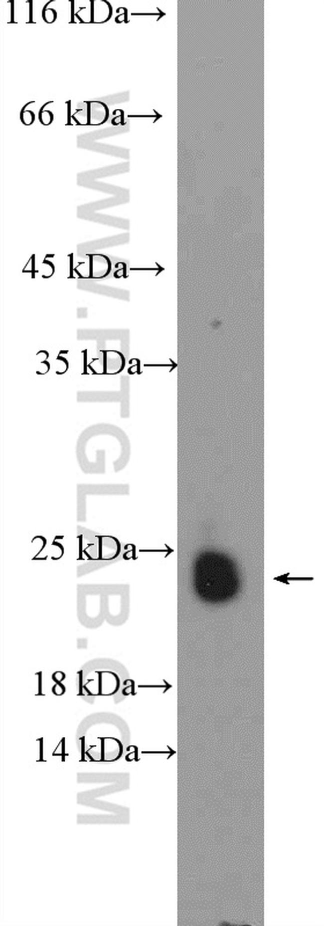 ASF1B Antibody in Western Blot (WB)