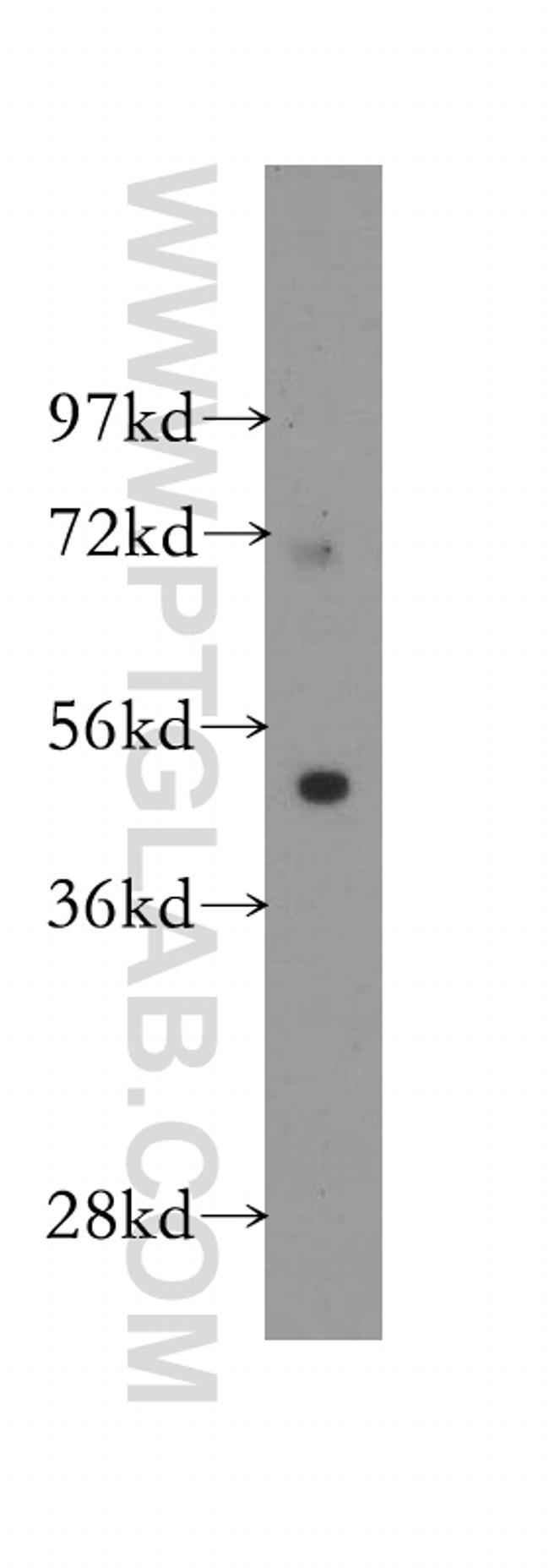 FATP4 Antibody in Western Blot (WB)