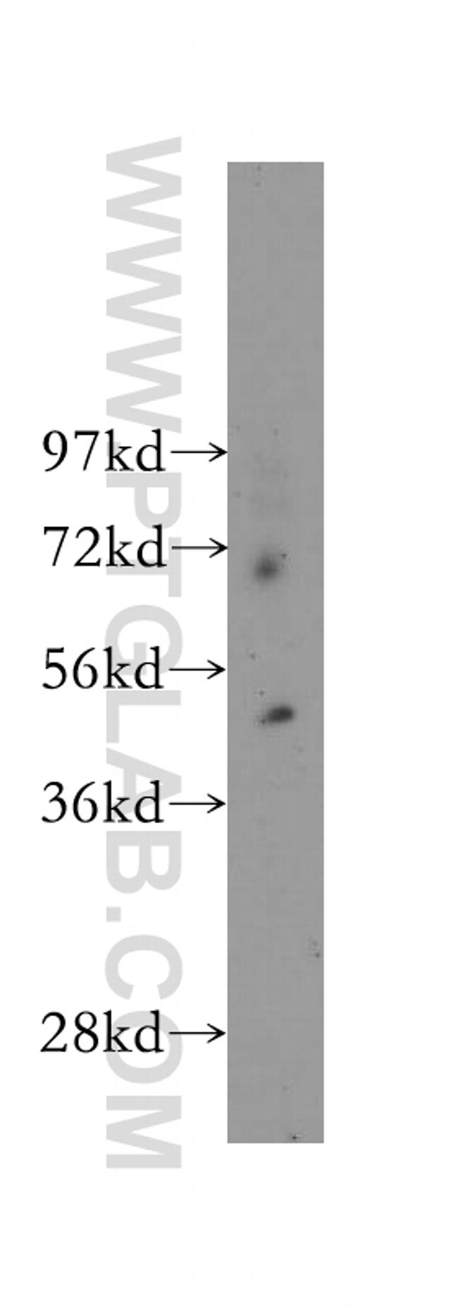 FATP4 Antibody in Western Blot (WB)