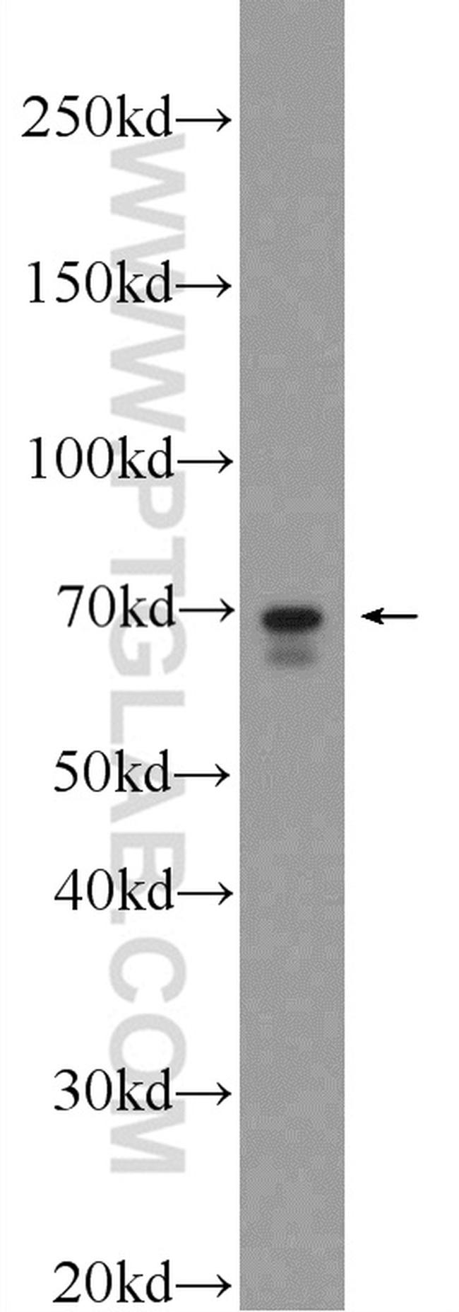 FATP4 Antibody in Western Blot (WB)