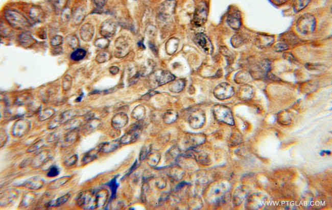 FATP4 Antibody in Immunohistochemistry (Paraffin) (IHC (P))