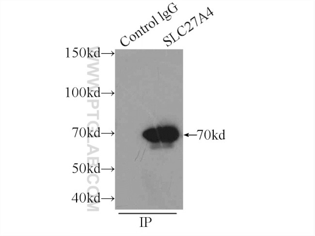 FATP4 Antibody in Immunoprecipitation (IP)